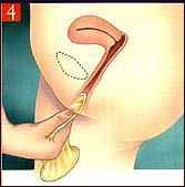 �k�ΫO�I�M�� �� �ܽd�Ϥ��|