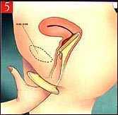 �k�ΫO�I�M�� �� �ܽd�Ϥ���