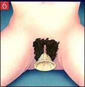 �k�ΫO�I�M�� �� �ܽd�Ϥ���